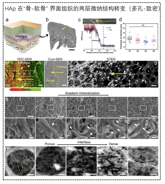 ZJE scientists identify ultrathin osteochondral interface tissue at human knee joints